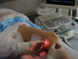 Лазерные технологии в лечении варикоза